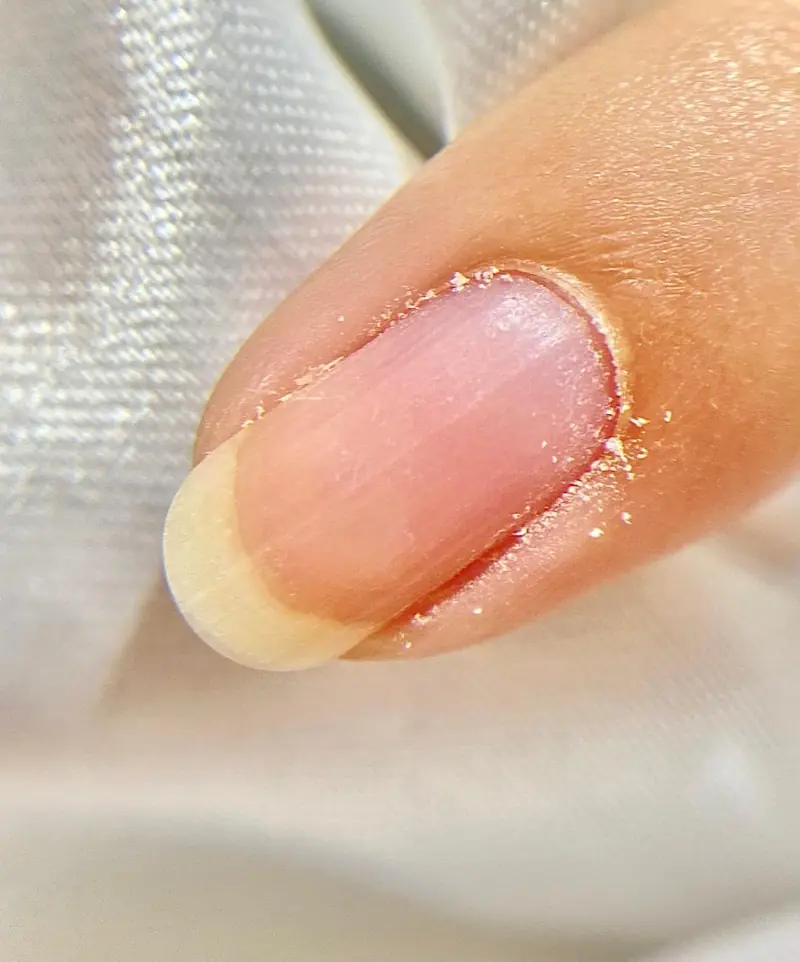 Cuticle lifting and pocket creation